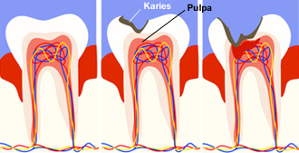 Endodontologie
